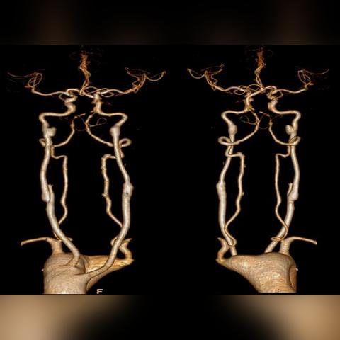 荒野起源：揭秘狩猎直弓的神秘获取途径！