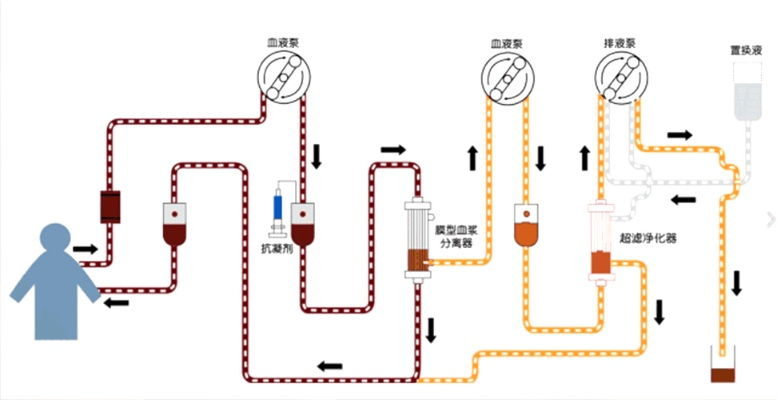 沙丘觉醒：揭秘血液净化器高效使用攻略