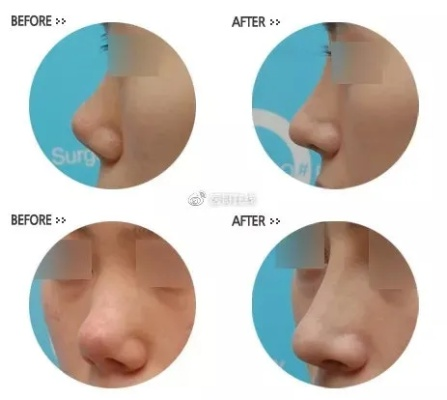 颜值揭秘：15基因塑造美，鼻子定义颜值巅峰！