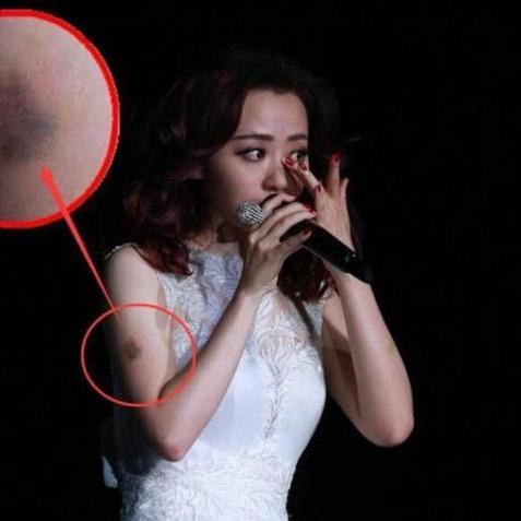 张靓颖演唱会惊险瞬间：舞台升降台意外踩空，揭秘坠落真相！