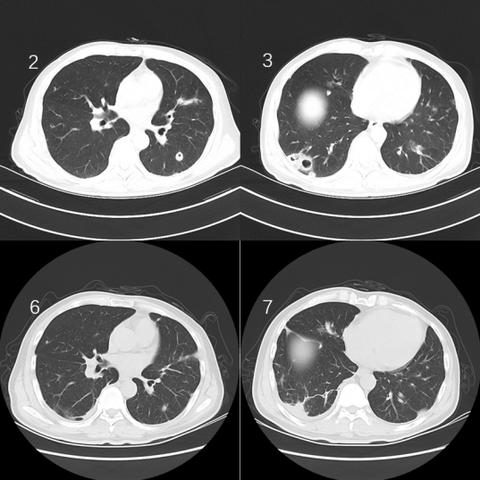 《丝之歌跑图攻略》升级版：深度解析《空洞骑士》高效路线技巧