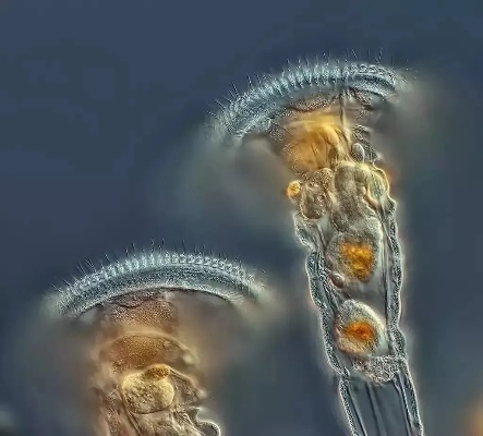 切尔诺贝利之心：纤毛虫超自然现踪点与神秘效应解析