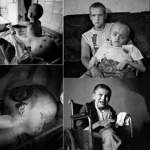 怪异球获取攻略：揭秘切尔诺贝利之心新玩法