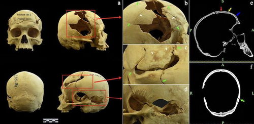 特技演员头骨骨折惊现《假面骑士》片场，安全新规紧急启动