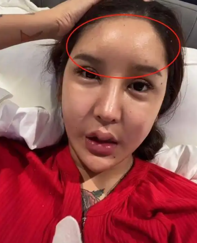 巴西网红芭比整形27次后离奇身亡，揭开伤痕背后的惊人真相