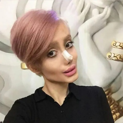 27次整形后芭比网红离奇身亡，揭秘伤痕背后的惊人真相