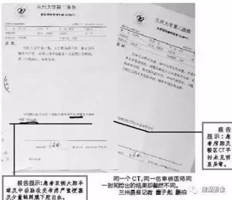 扇耳光大赛中国选手倒地病历曝光，视觉重影需手术解决新方案