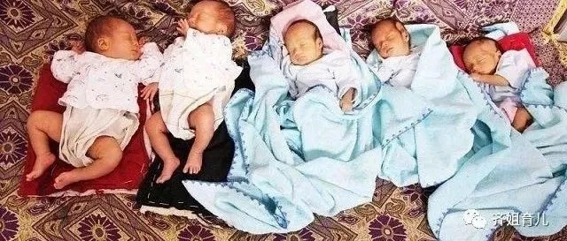 七胞胎奇迹28岁生日：世界首例婴儿期存活传奇诞生