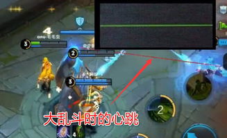 2025全民乱斗报名启动！挑战乱斗之王，勇夺荣耀巅峰！