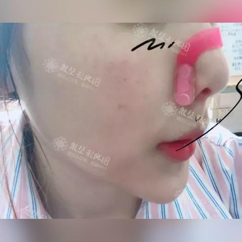 神器传说快速升级秘籍：高效速成攻略新解法