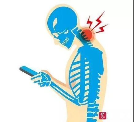 女子拒绝手术当晚瘫痪，医生紧急提醒：颈椎脱出压神经，翻身玩手机需警惕！