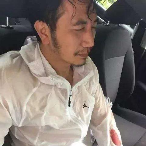 腿神器穿反致胸闷，急救室揭秘惊险一幕