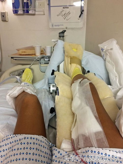 23岁女孩高考晕倒确诊骨癌，历经6次手术截肢，书写生命奇迹