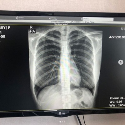 天然美胸女星丰岛心樱X光曝光：肺照见证自然之美