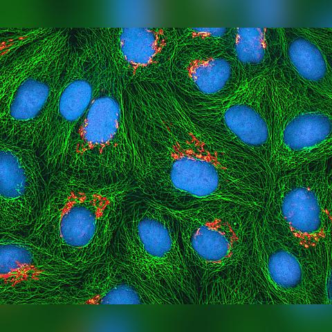 荧光水母有哪些类型？匹配造景/科研/观赏需求的小众适配实战全攻略