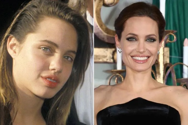 脸部变形不敢见人!好莱坞女星崩溃:我一夜老了20岁