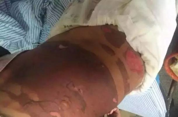 女子花10万做折角腰整形 醒来后浑身血水