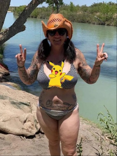 53岁女星因"隆胸"毁容！填充物破裂并渗漏