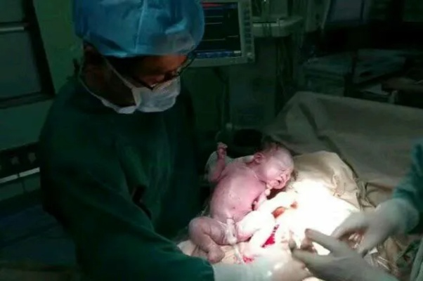 63岁女子顺产5.6斤女婴 此前儿子35岁不幸离世