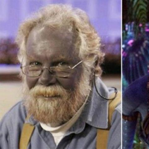 男子醒来变"阿凡达"吓坏医生 皮肤变蓝 真相离谱