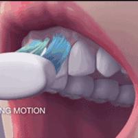 睡觉前才刷牙是错误的？医生：很多人都在无效刷牙