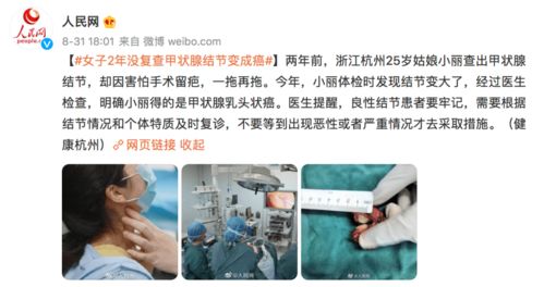 知名Coser宣布抗癌成功！女性常见的甲状腺乳头状癌